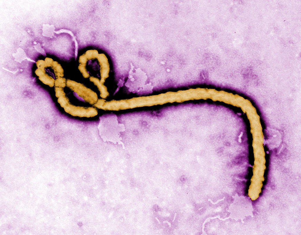 Guinea Reported Seventh Case of Ebola